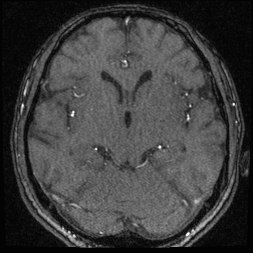 Click on the Serie image to view the images of VILLANUEVA, WILLIAM A.